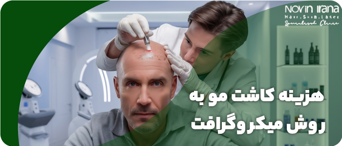 قیمت کاشت هر تار مو